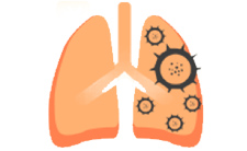 <strong>兰泽替尼片（LuciLazer）拉泽替尼说明</strong>