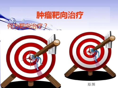 肺癌目前治疗的方法，患者应该了解一下，什么方法最合适自己