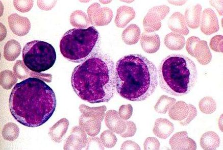 威托克 威托克的服用禁忌是什么?