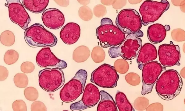 依鲁替尼 依鲁替尼的出现让病患的生存期延长