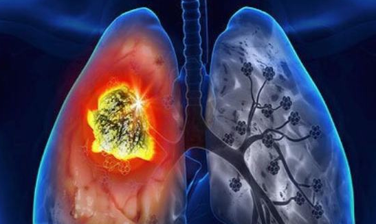 肺癌患者服用奥希替尼会有哪些副作用？