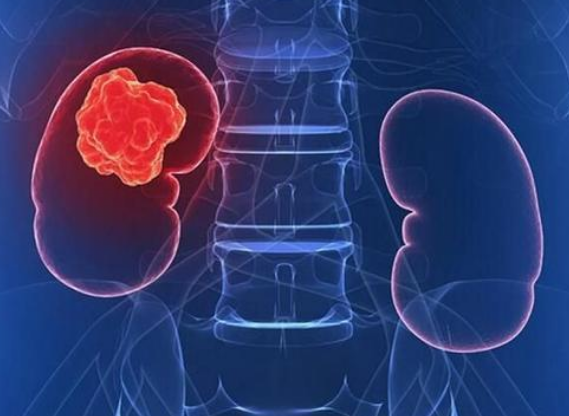 依维莫司与阿昔替尼的药物的作用机制有何不同