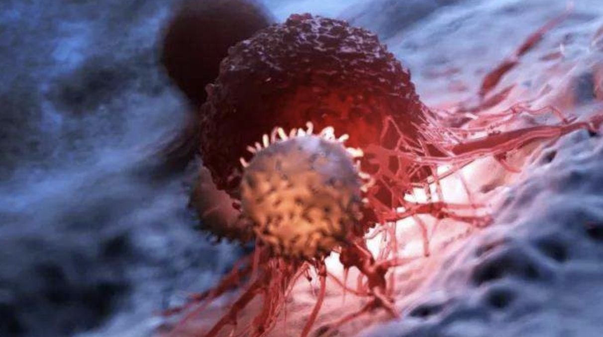 胃癌能用CAR-T治疗吗?