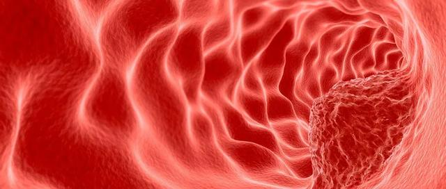 警惕!让人闻之色变的喉癌,竟与这个东西相关!