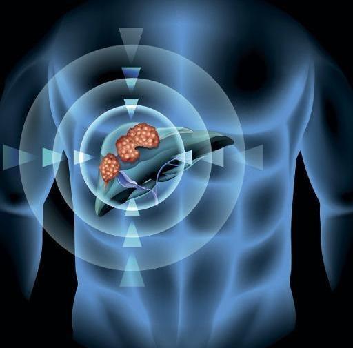 目前市面上有什么好的抗癌药?肿瘤科医生说出了答案