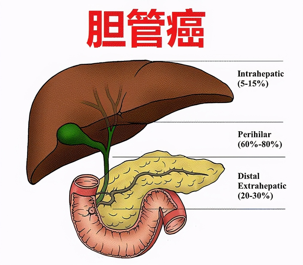 三大靶点,五大药物,吹响胆管癌新药集结号
