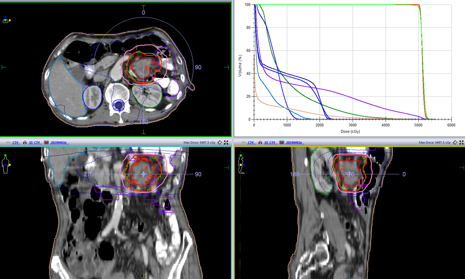 1621843107690468.png 晚期食管癌免疫治疗:雷替曲塞+PD-L1(转)