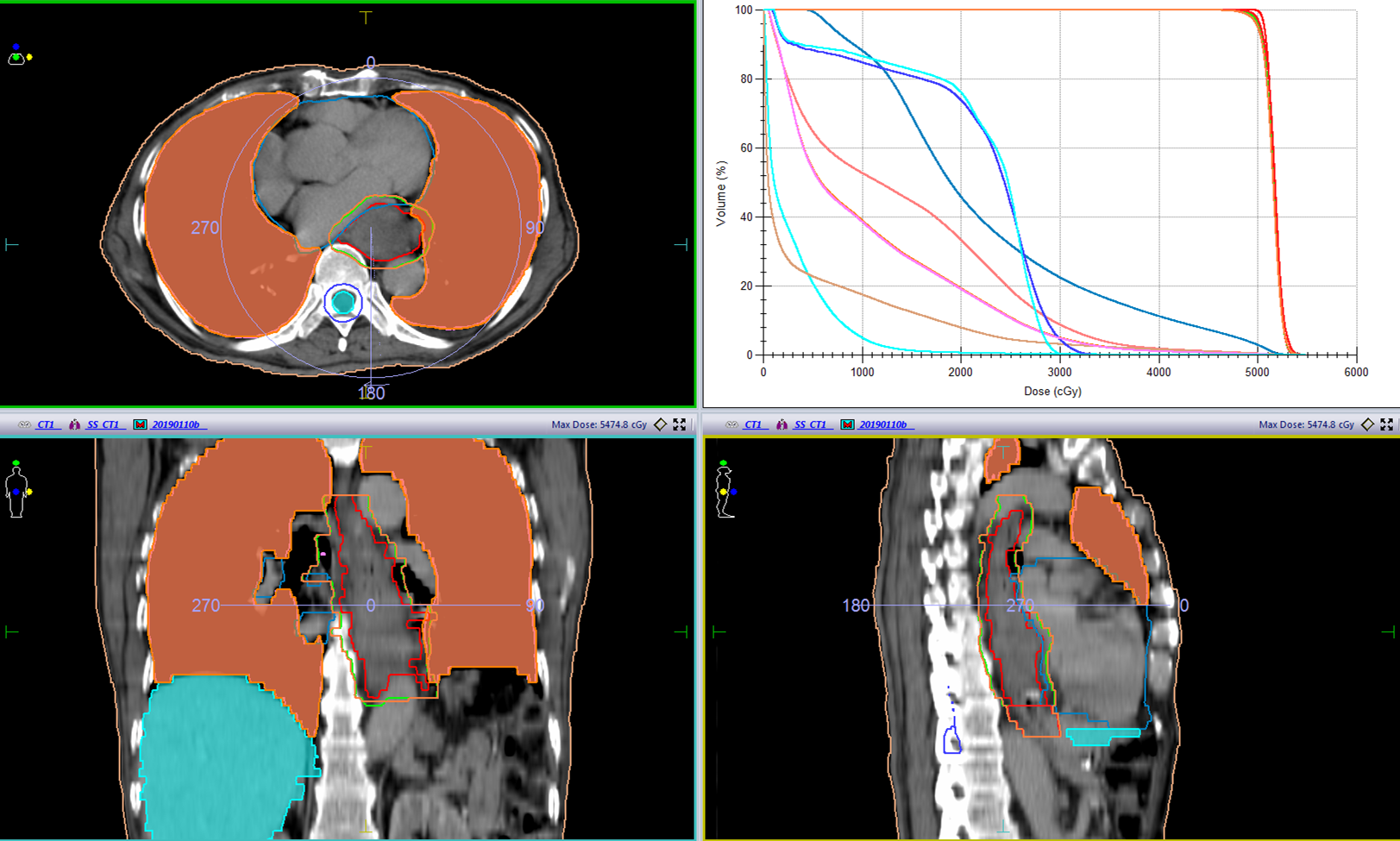 1621843080298665.png 晚期食管癌免疫治疗:雷替曲塞+PD-L1(转)