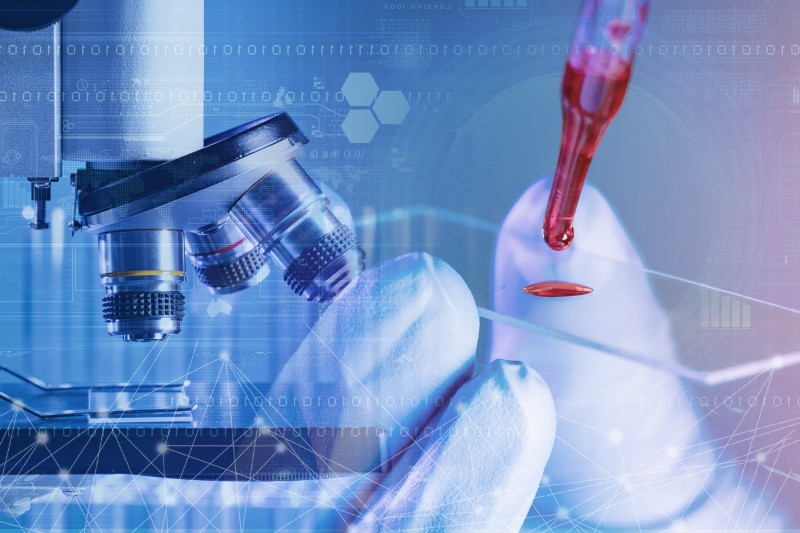 Alk基因检测,Alk融合基因检测,Alk基因检测费用、价格